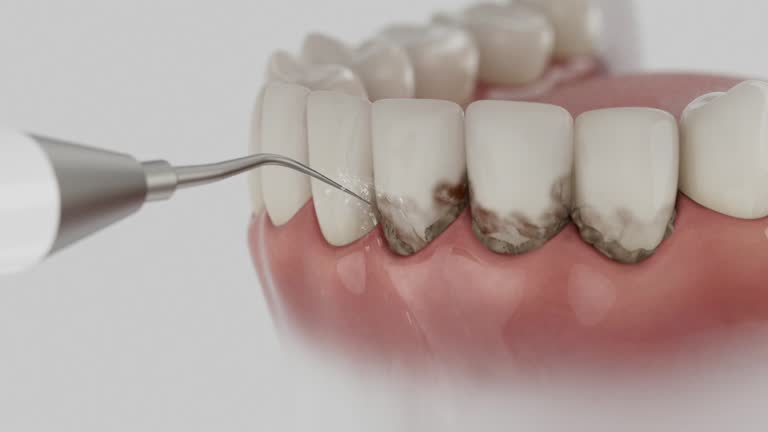 Reliable Tooth Extraction contractor in Meridian, MS by Smile Center Dentistry